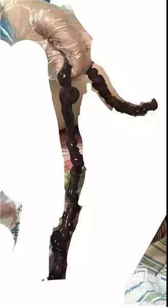 39周宝宝胎死腹中,ta的求救信号妈妈却没有读懂