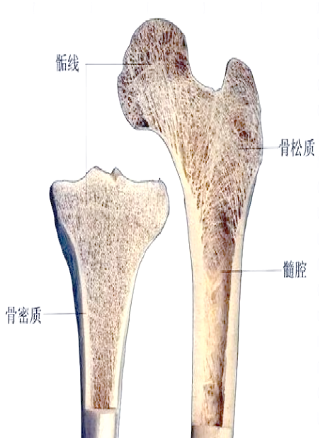 导致骨折部位的骨小梁无法直接牢固愈合,进而