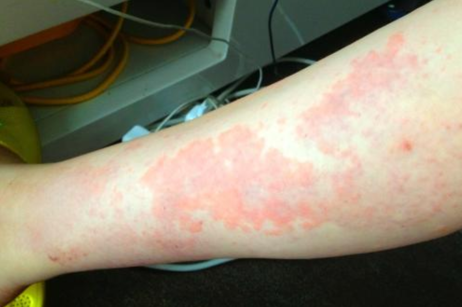 你是在"瞎折腾",还是在减肥?想要减肥,或应该坚持这一项运动