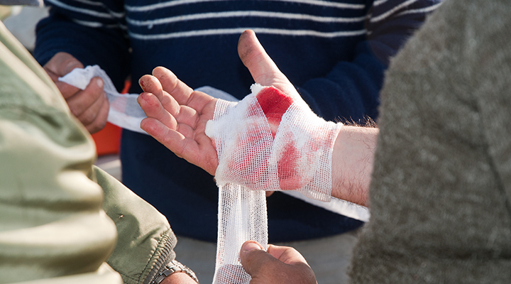 外伤出血的急救