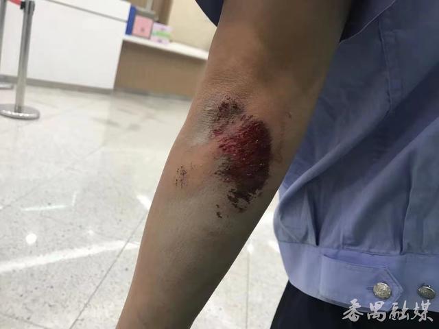 无牌摩托冲卡逃逸 番禺小谷围街一执勤辅警受伤