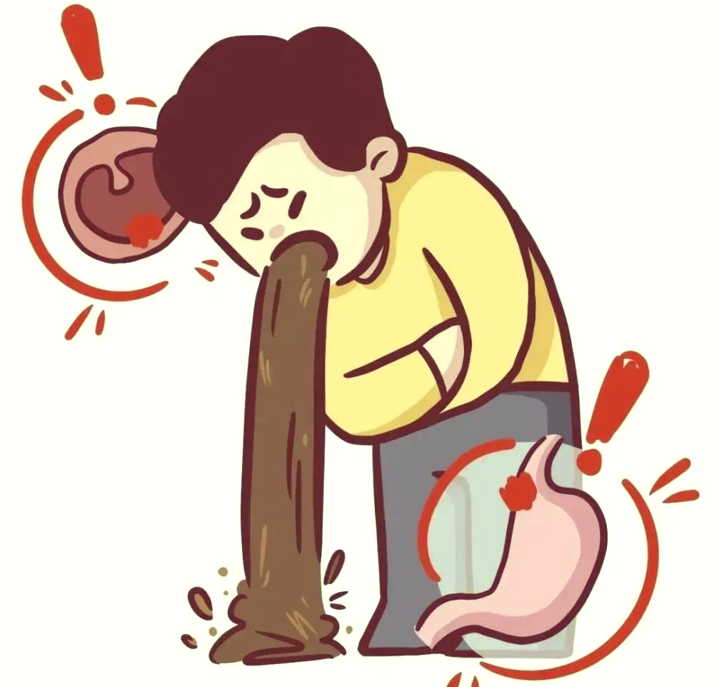 喝酒引发严重吐血,内镜下止血成功挽救生命!ps:饮酒需谨慎,珍惜健康