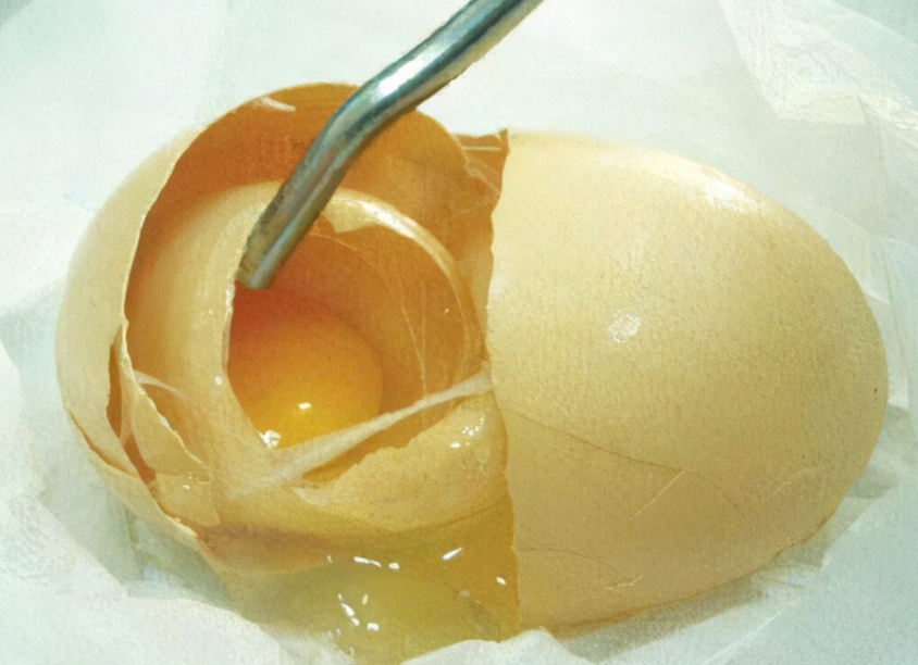 「蛋小秦」为什么会出现畸形蛋?