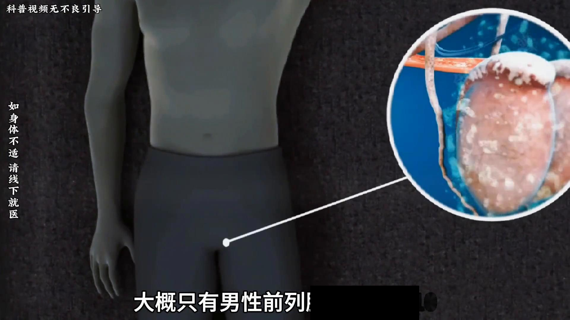 你知道斯基恩氏腺嘛?它究竟是如何形成的呢