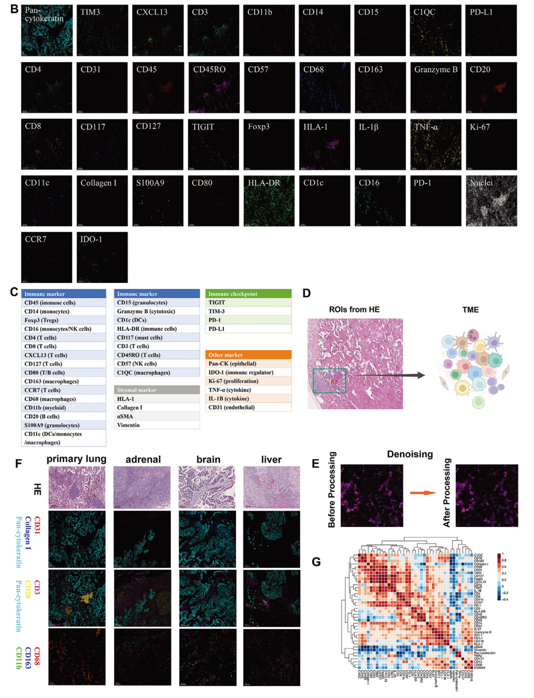 advanced science丨科研人员利用vita平台揭示肺腺癌器官特异性肿瘤微