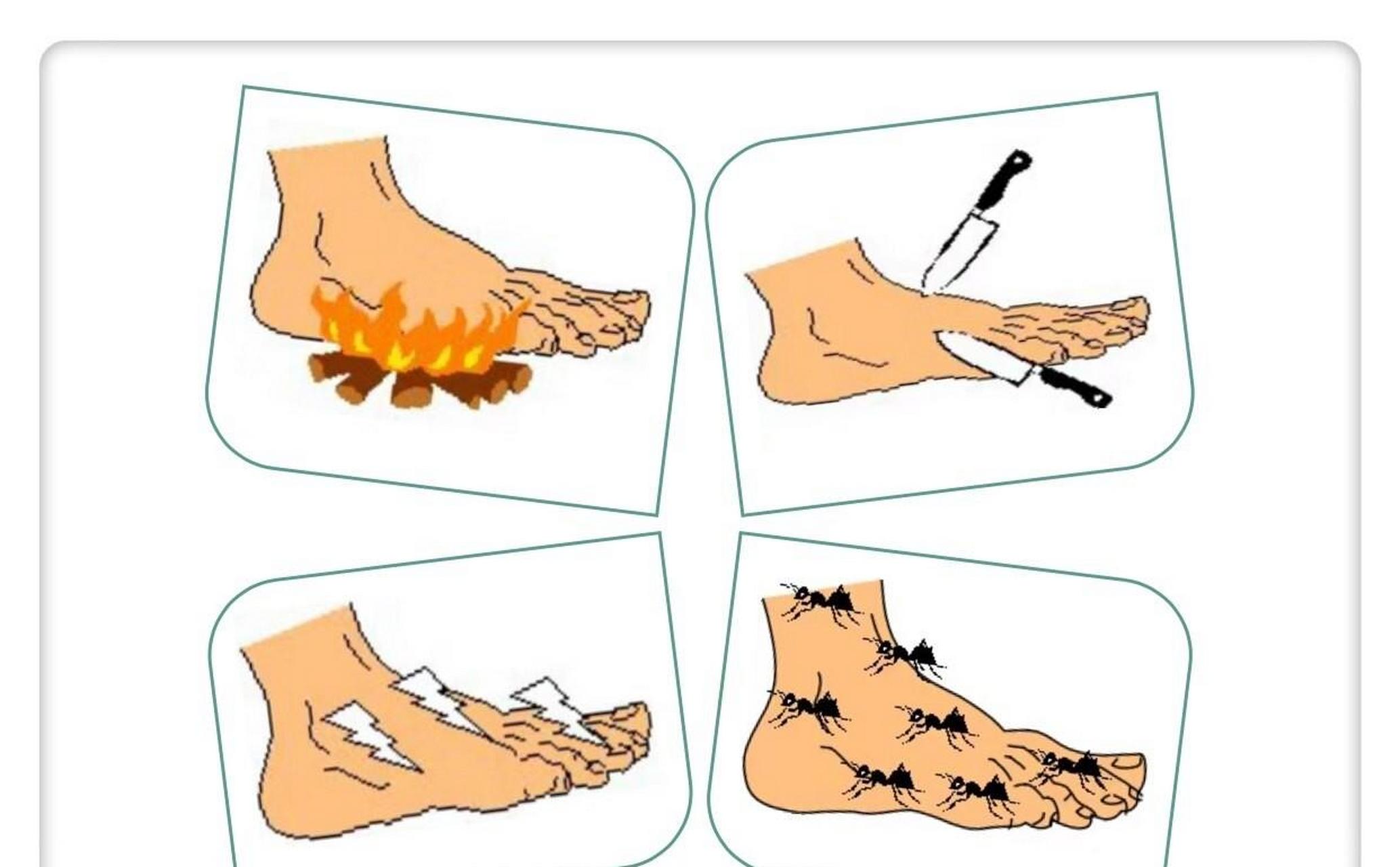 糖尿病足发展过程,你到哪一步了?  1.脚麻,有灼热感,蚁行感  2.