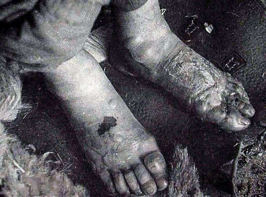 日本731细菌部队图片图片