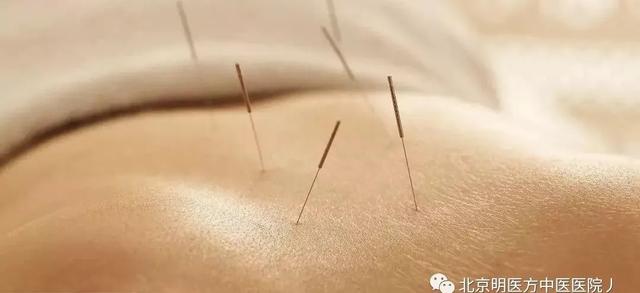 「王荣国教授讲疼痛」背痛20年就求一个明确诊断