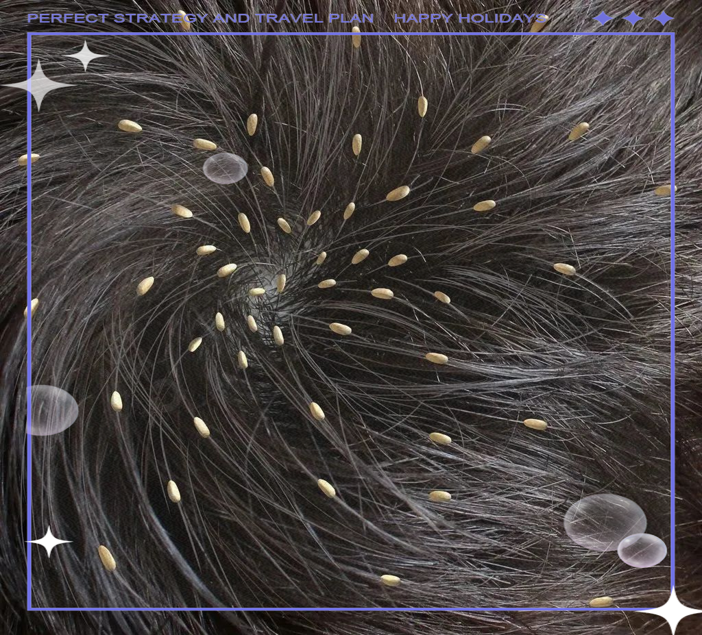 为何头上虱子消失了?人类进步带来新答案