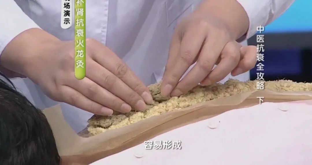 房繄恭:火龙灸"四位一体"事半功倍