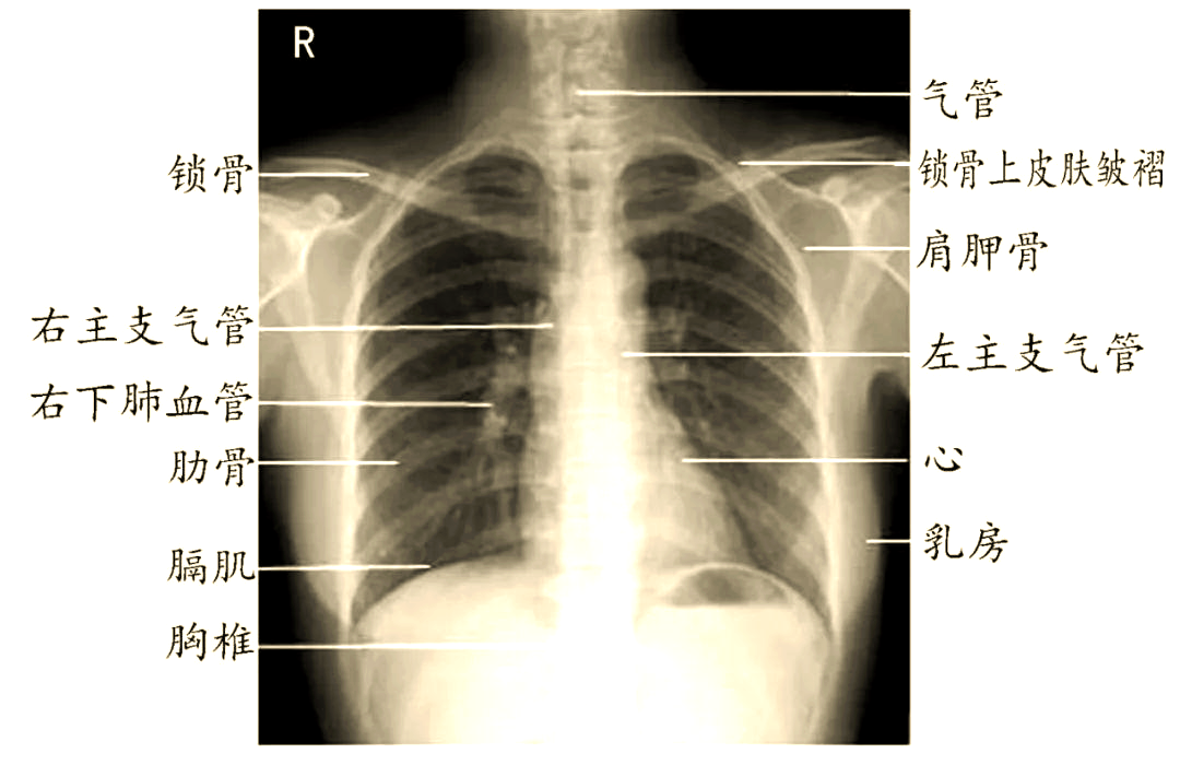 x线视角:心脏结构与腹部解剖深入解析