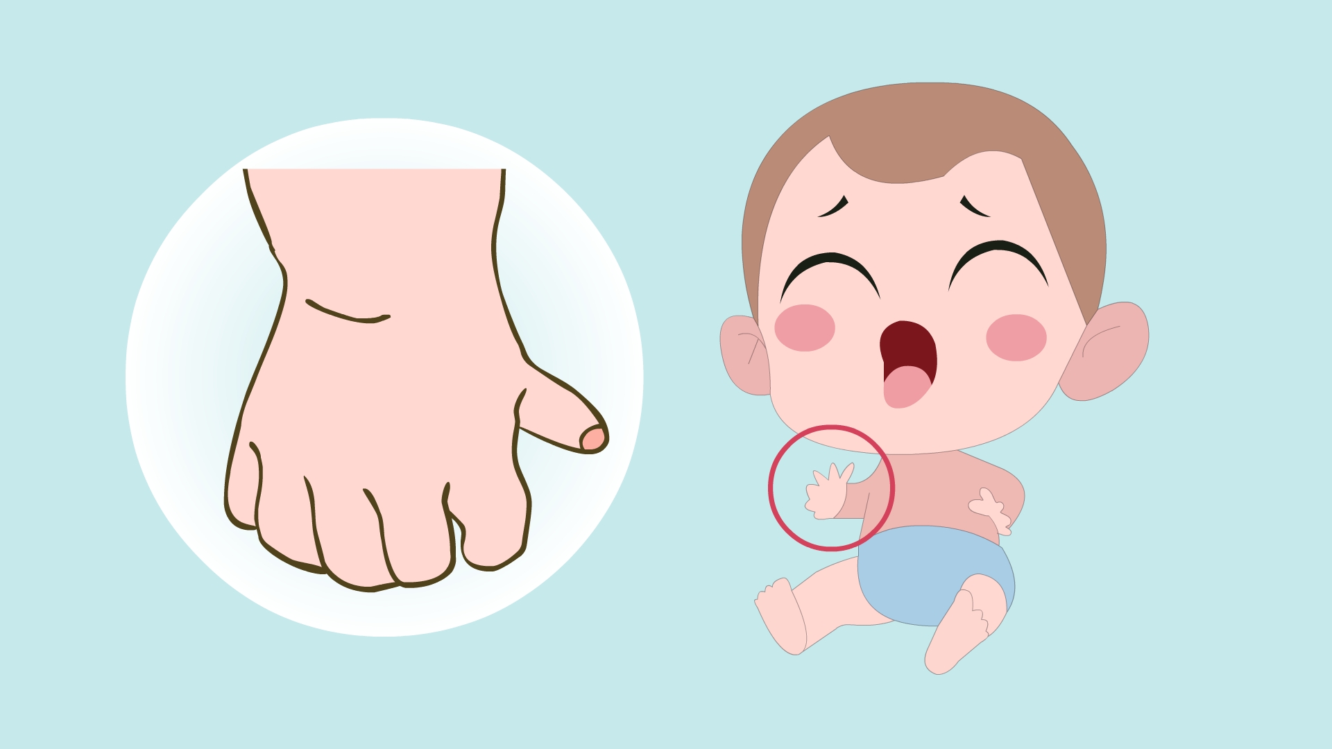 儿童长期吸吮拇指或使用安抚奶嘴会对口腔健康有何影响?如何戒掉