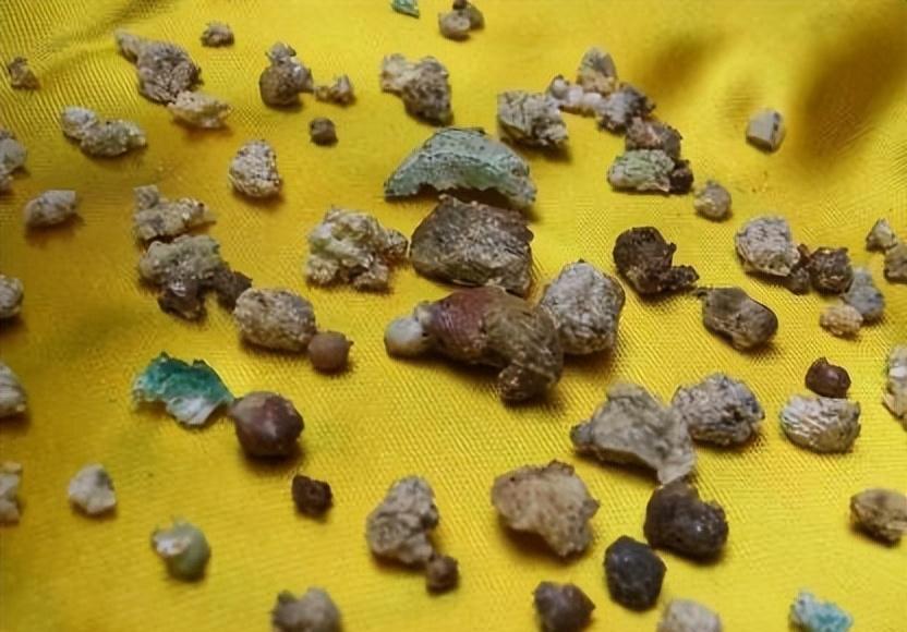 为何高僧火化会有舍利子,而普通人只有骨灰?舍利子怎么形成的?