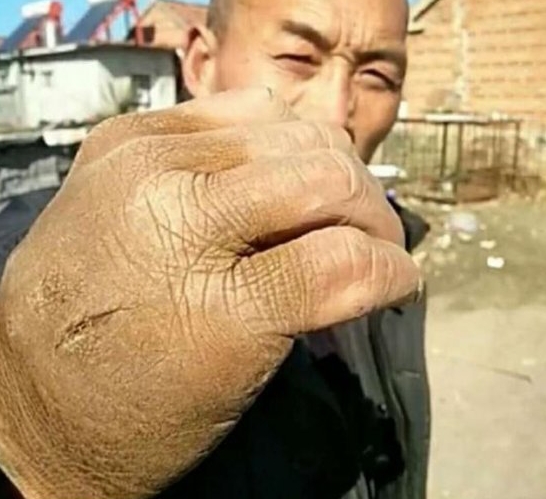 铁砂掌在表演时可以开碑裂石,为什么到了擂台上发挥不出来呢?