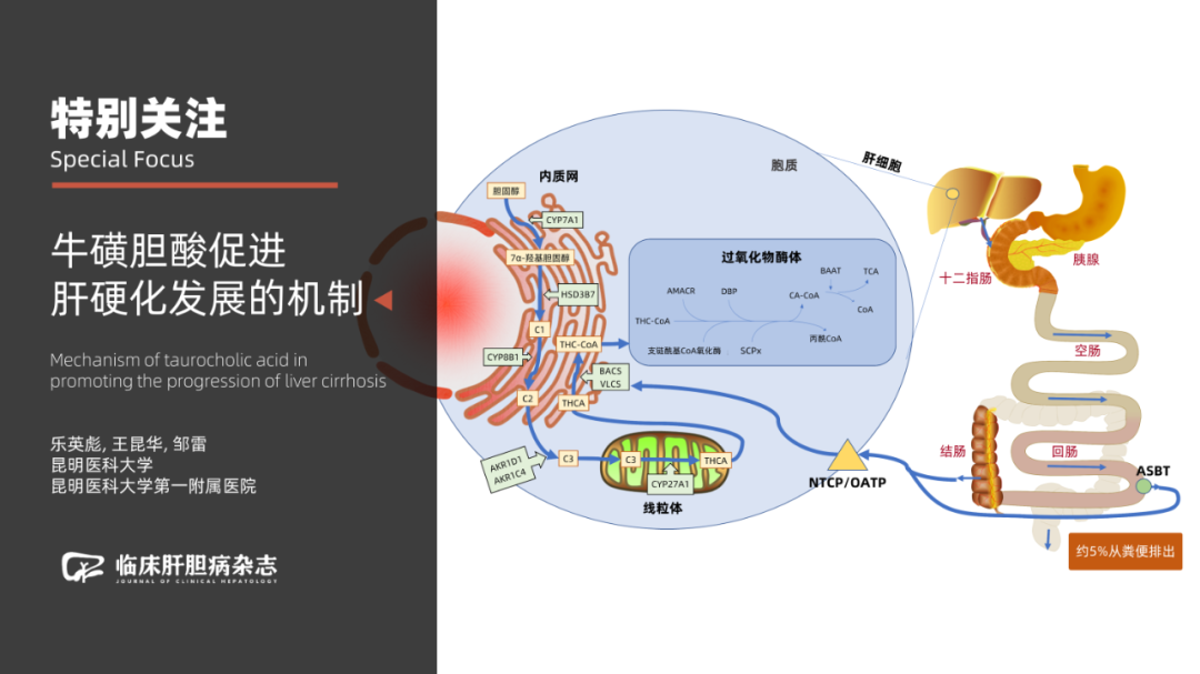 特別關注|牛磺膽酸促進肝硬化發展的機制