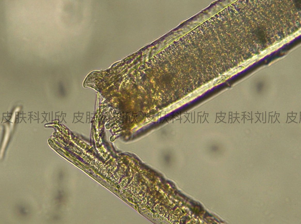 猫癣的诊断与治疗方法