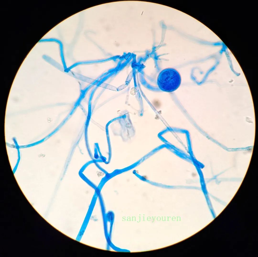 纯培养后 棉酚蓝染色(1000倍)纯培养后  棉酚蓝染色(1000倍)棉酚