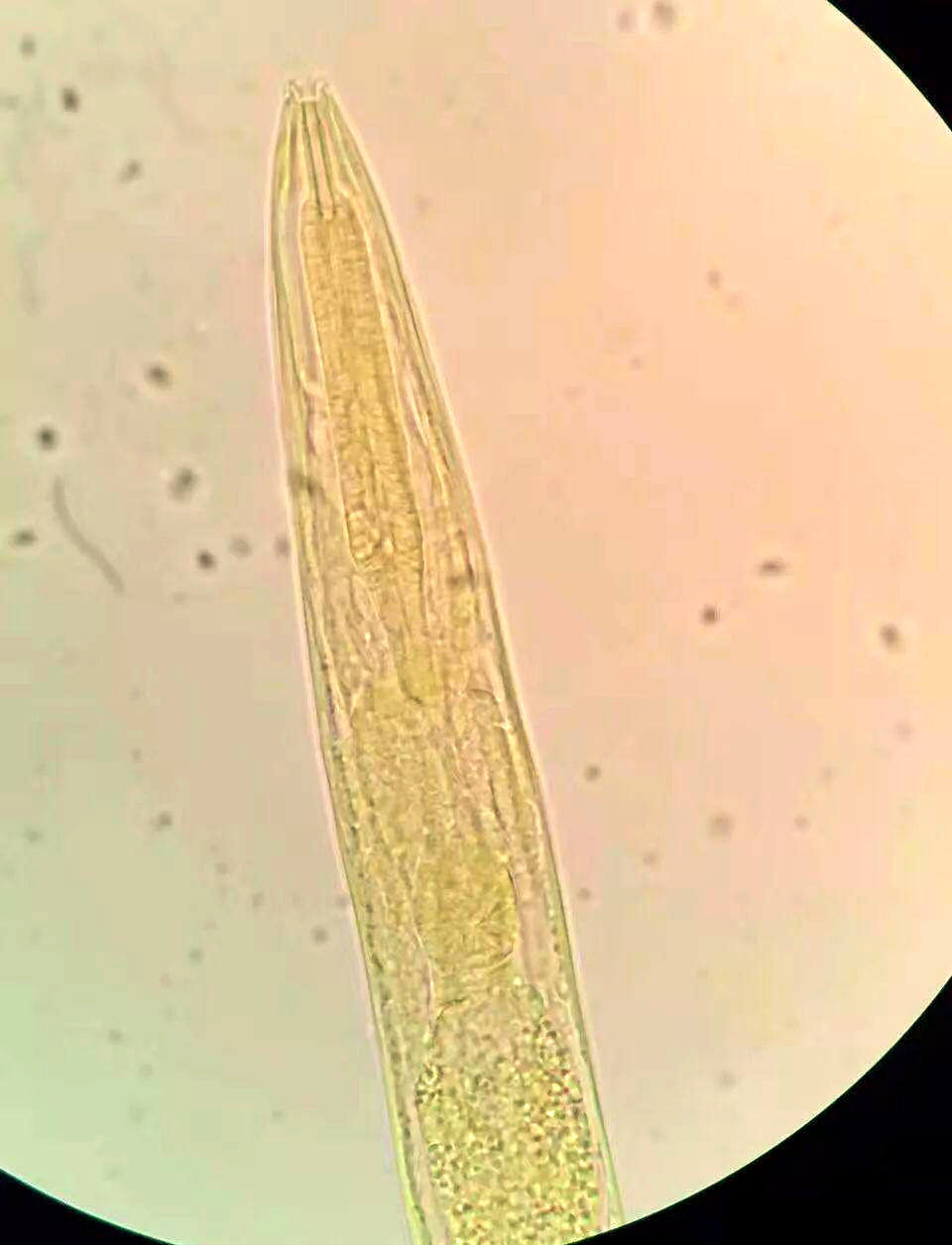 粪类圆线虫与钩虫幼虫的鉴别全攻略