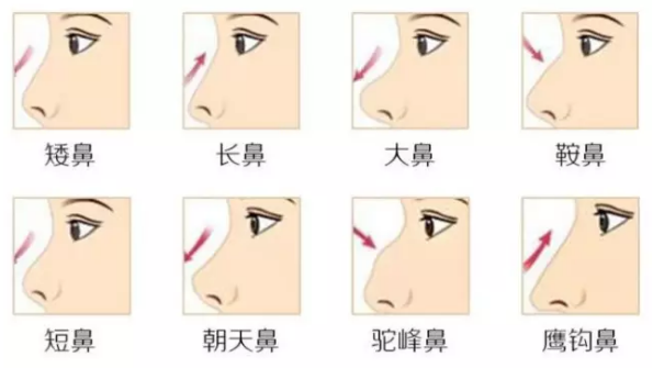 改善鼻型,气质提升一个档次