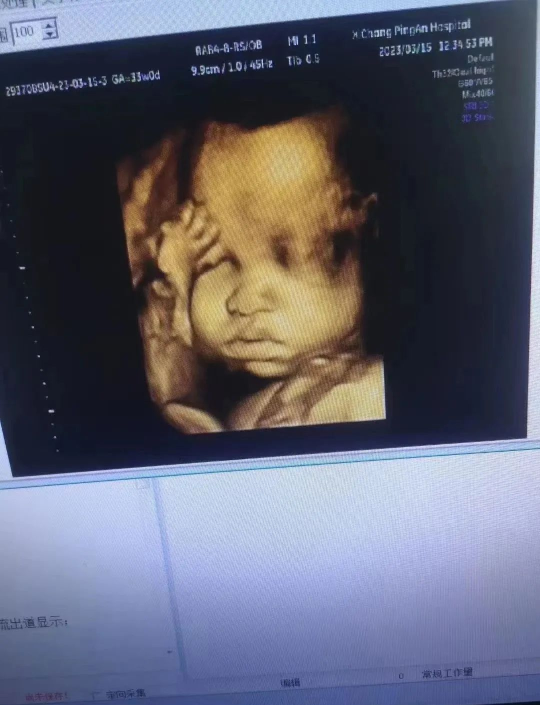 四维彩超高清图片大揭秘,萌宝照片来袭!