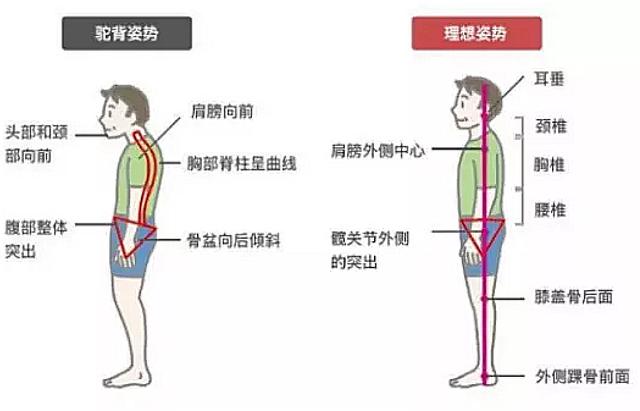 这个问题让你探颈