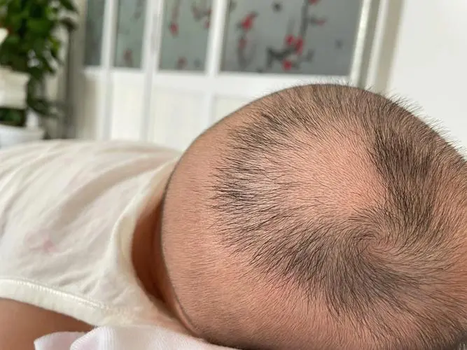 给满月的宝宝剃胎毛,会使头发长得又浓又密吗?对宝宝有伤害吗?