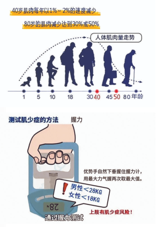 千金难买老来"肌"——老年人肌少症早知道
