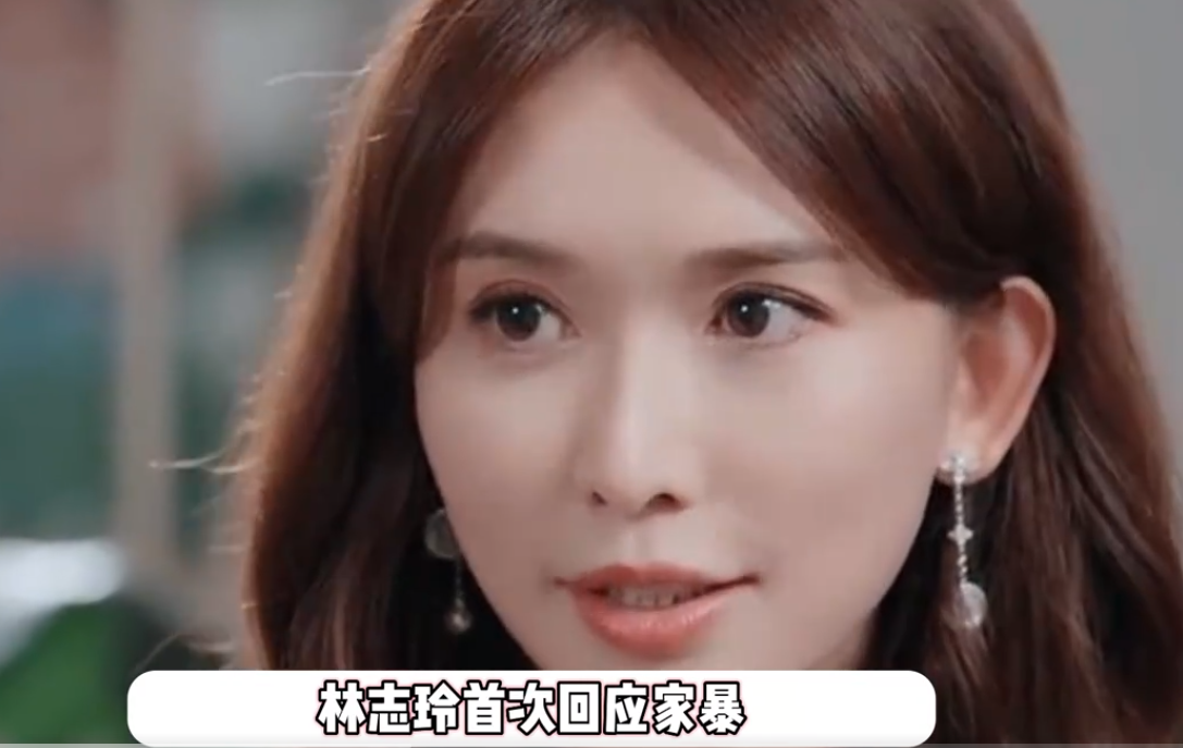 林志玲被家暴是真是假 林志玲回应家暴传闻