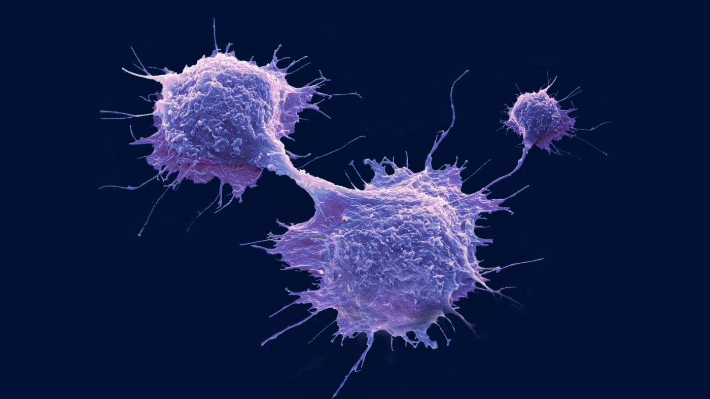 什么是抗原提呈细胞?它都有哪些种类?