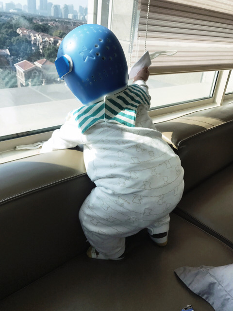 给婴儿用定型头盔?是不是傻