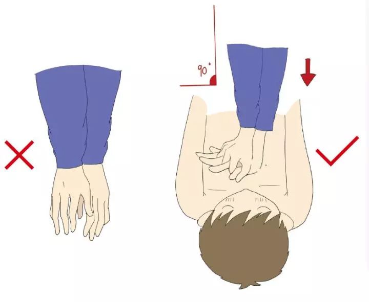 人工呼吸压胸位置图片