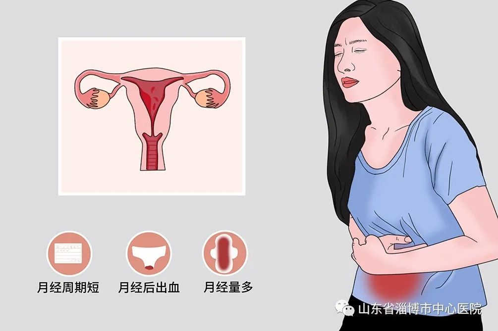 「科普」更年期功能性子宫出血需要注意什么?
