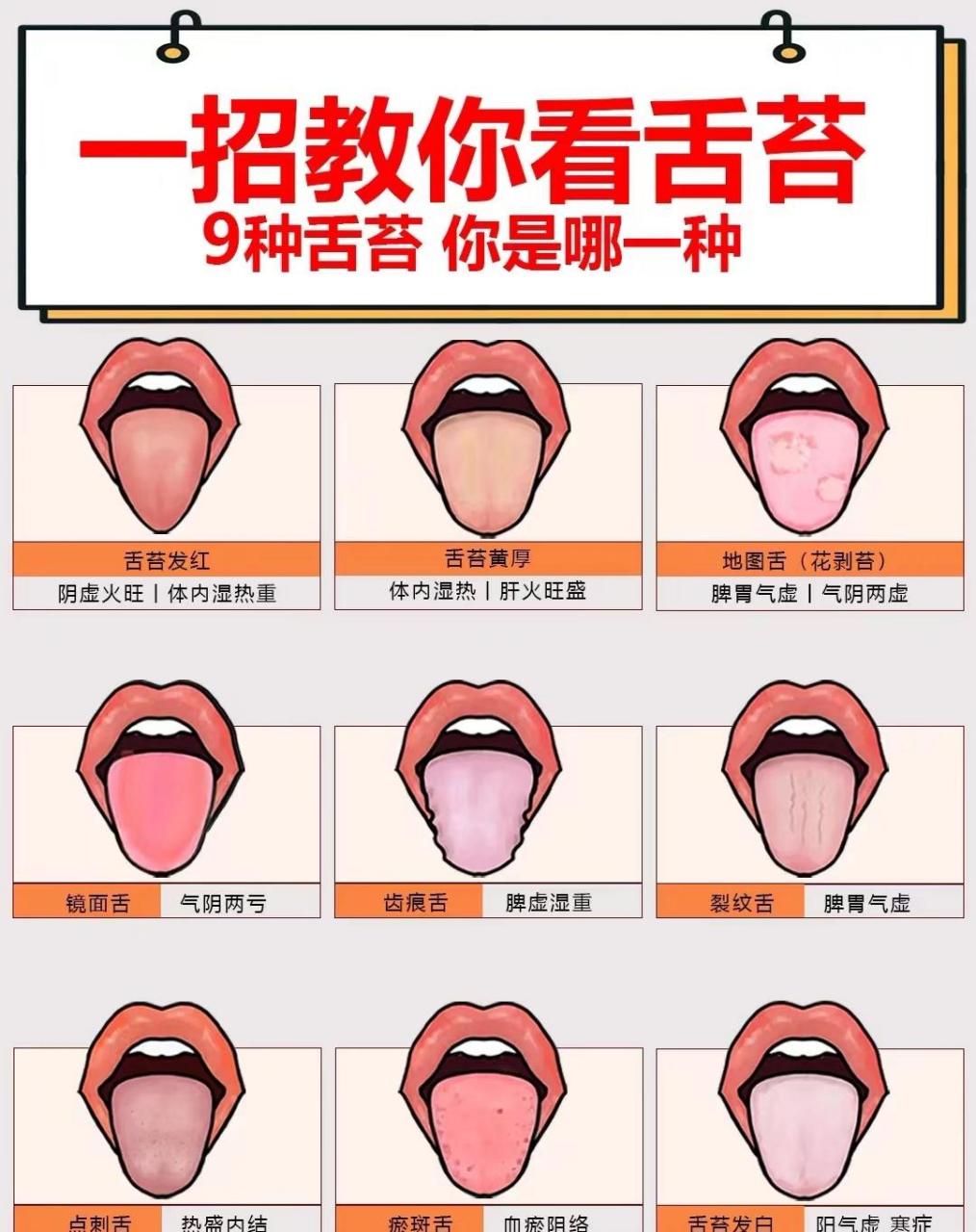 中医认为:舌面反映应身体的寒,热,虚,实,与五