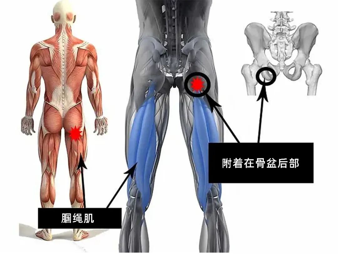 当你感觉大腿后侧紧绷