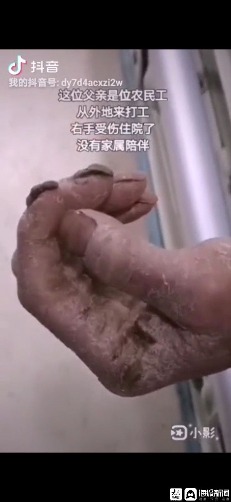 山东护士小姐姐给农民工大爷涂护手霜走红,网友热评"劳动的双手最美"