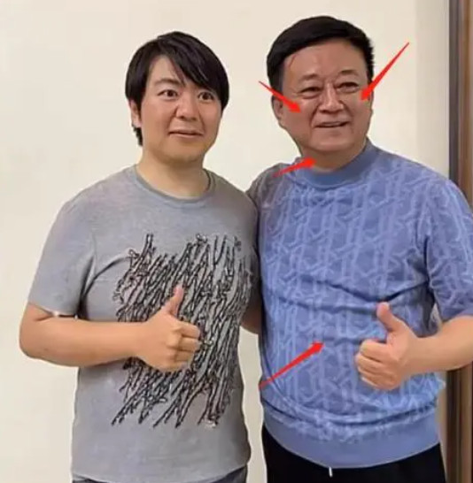 朱军近况引争议,身材发福大肚子格外明显,脖子胖到看不见