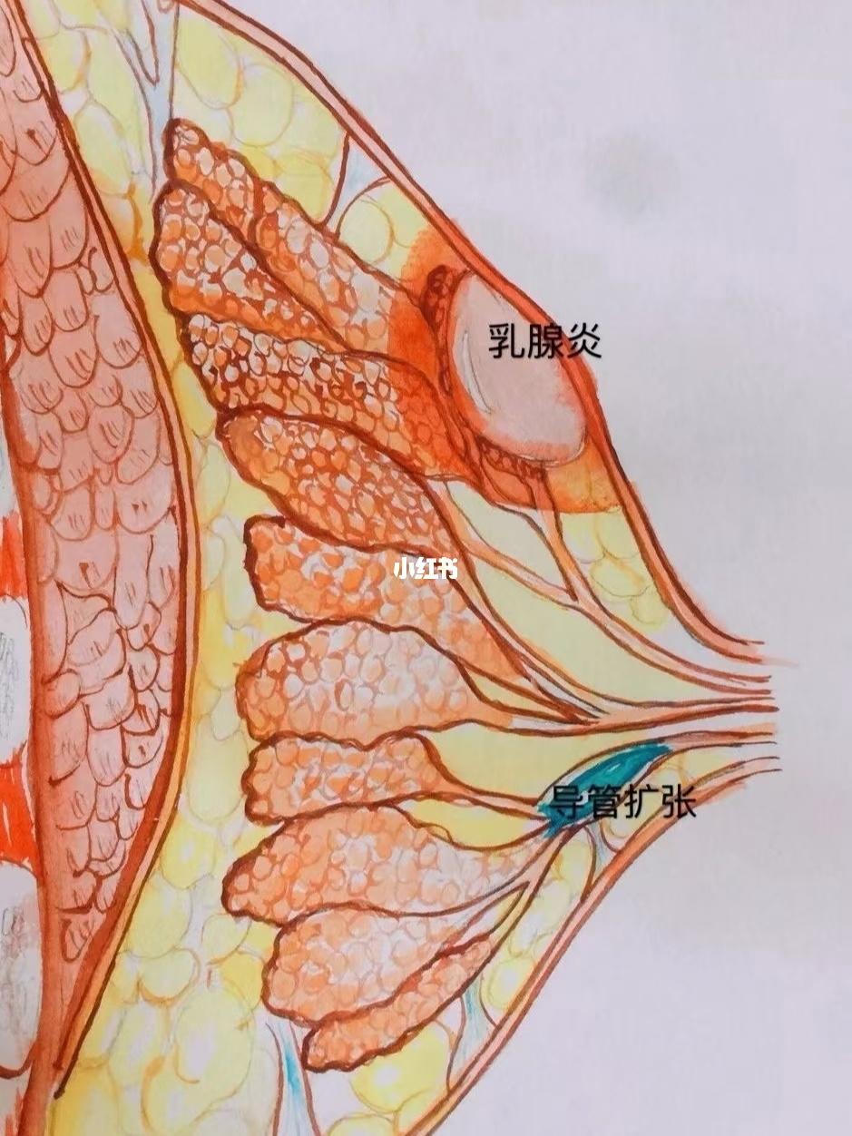 乳痈的症状图片图片