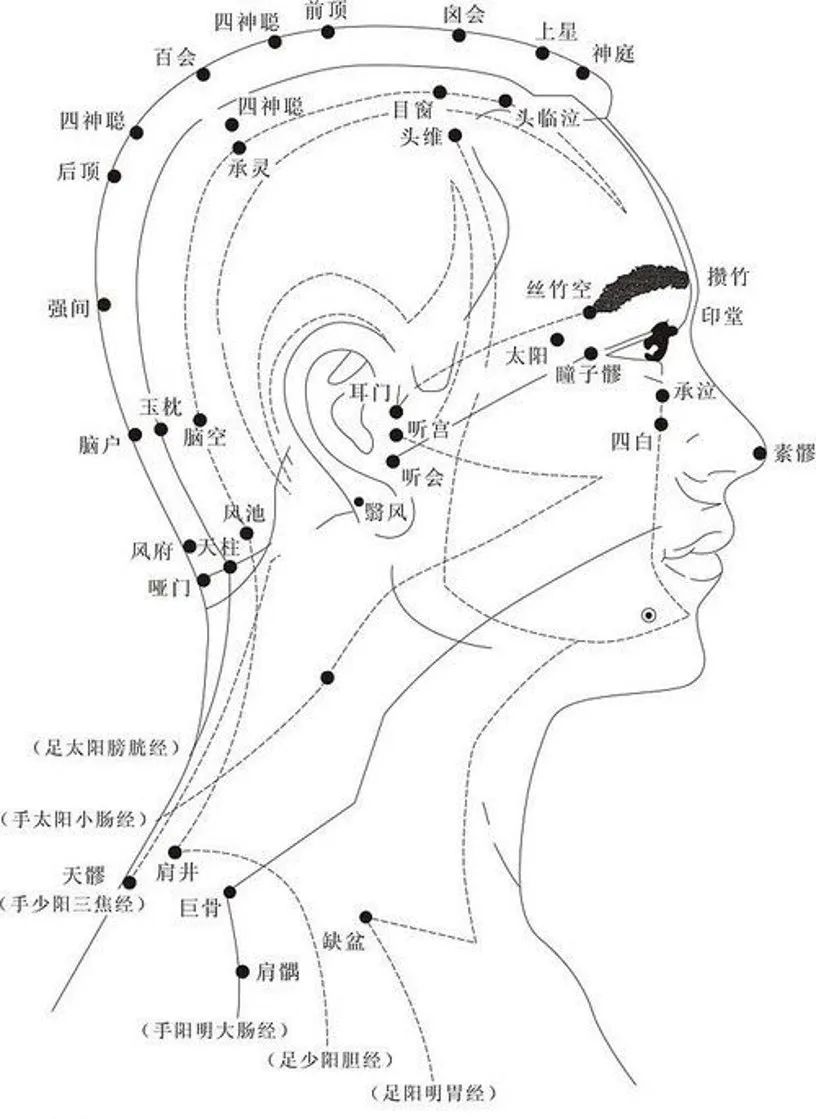 缓解不同部位头痛