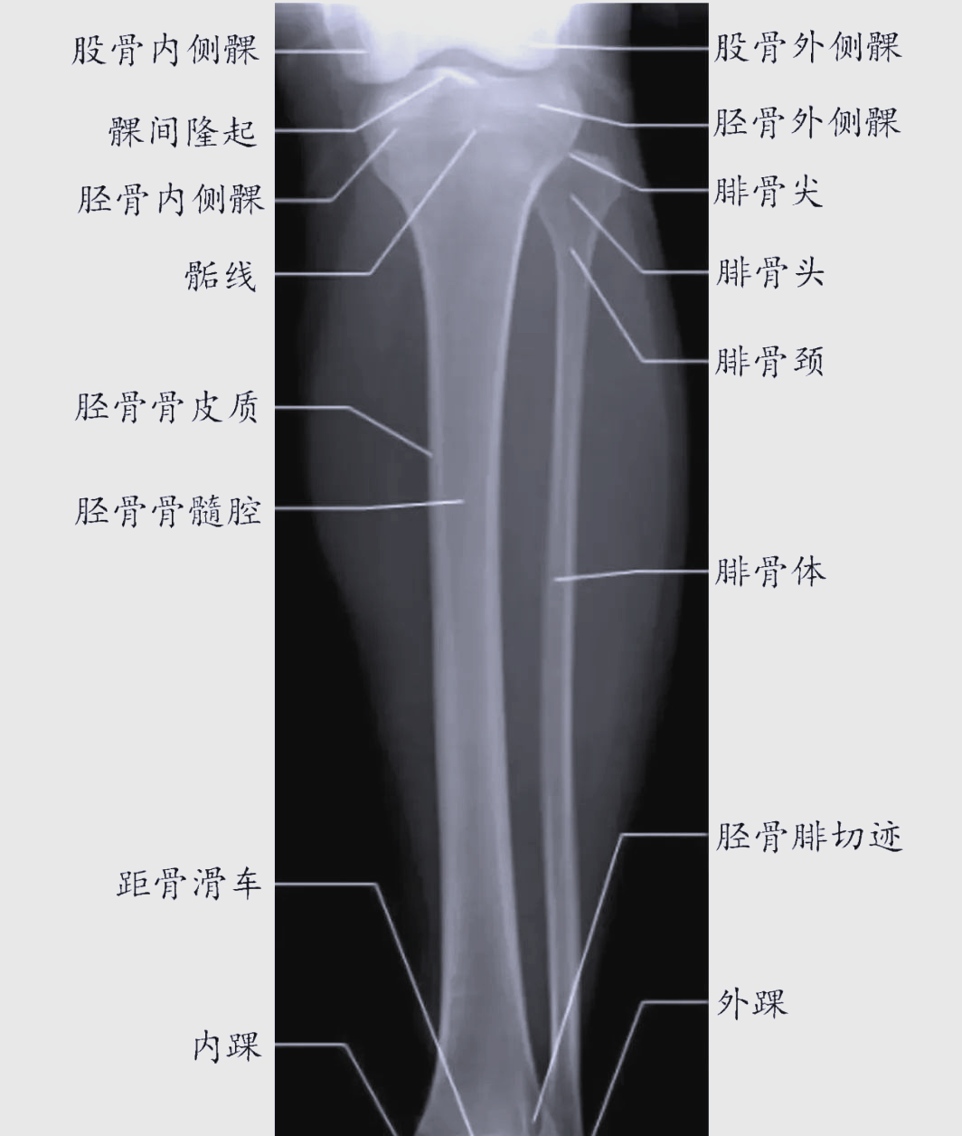 小腿骨结构与功能全解密胫骨与腓骨的独特作用