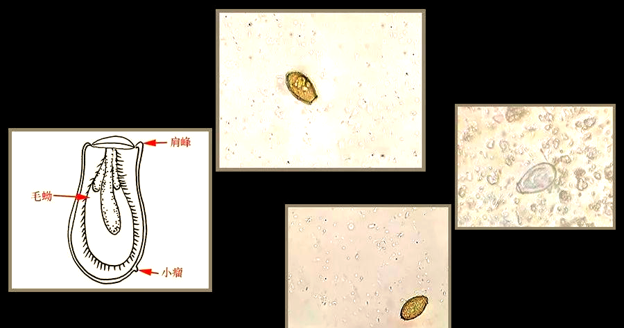 探索常见寄生虫卵的形态与大小