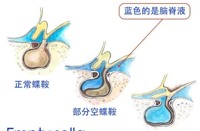 儿童脑垂体大小对照表图片