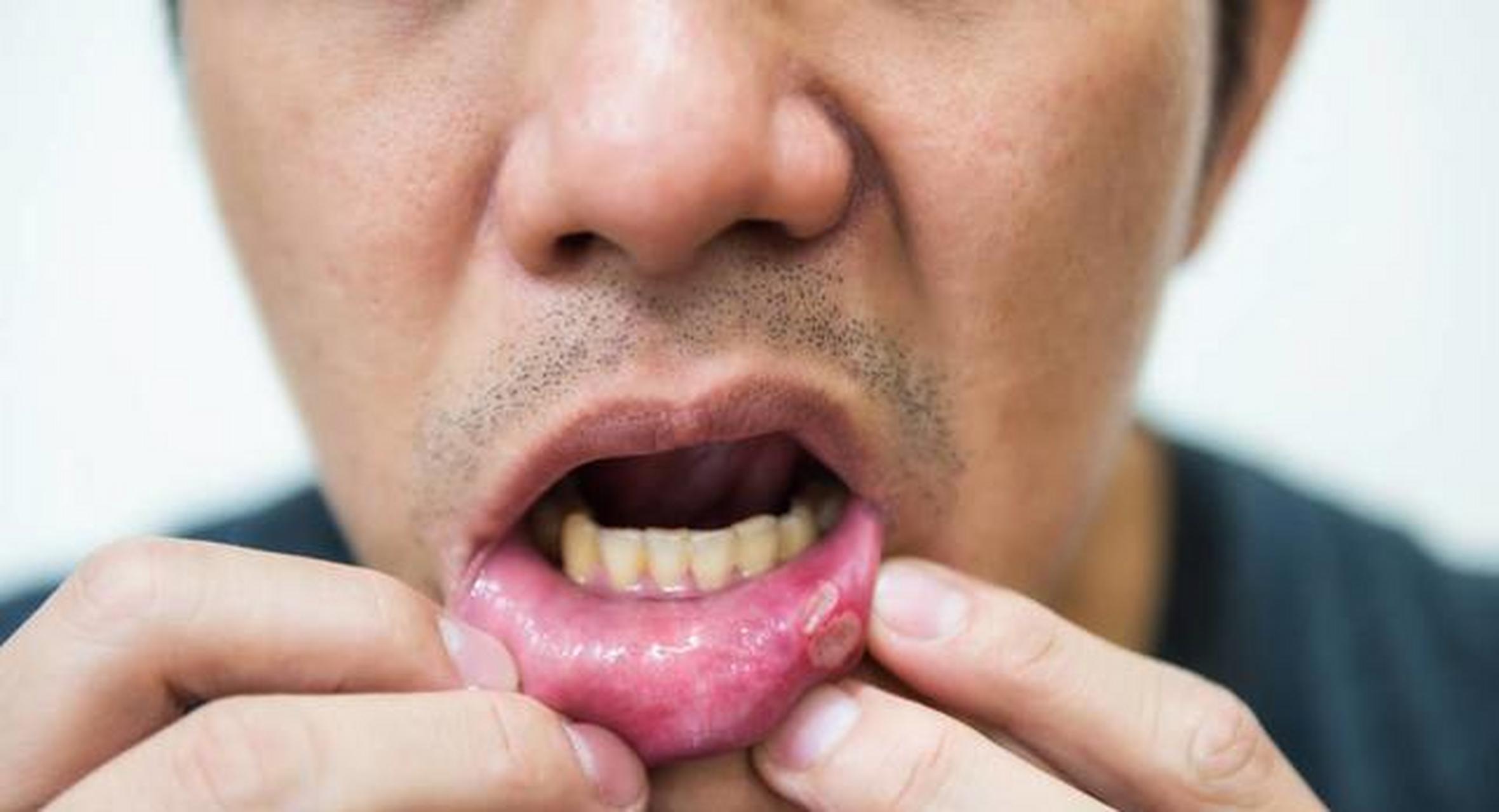 我大哥今年45岁,平时身体很健康,经常锻炼身体,身边