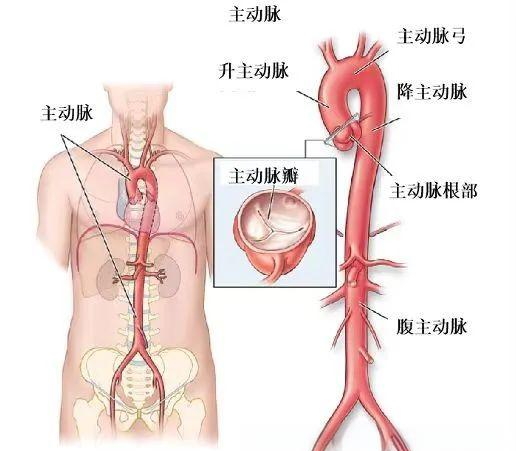 主动脉夹层:从预防到治疗的全面解析