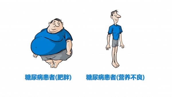 有关糖尿病的各种传言,专家来辟谣