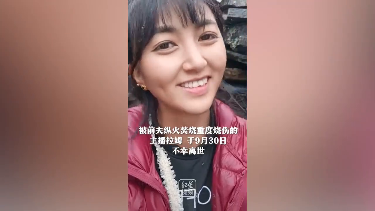 痛心!被前夫烧伤的网红拉姆不幸去世