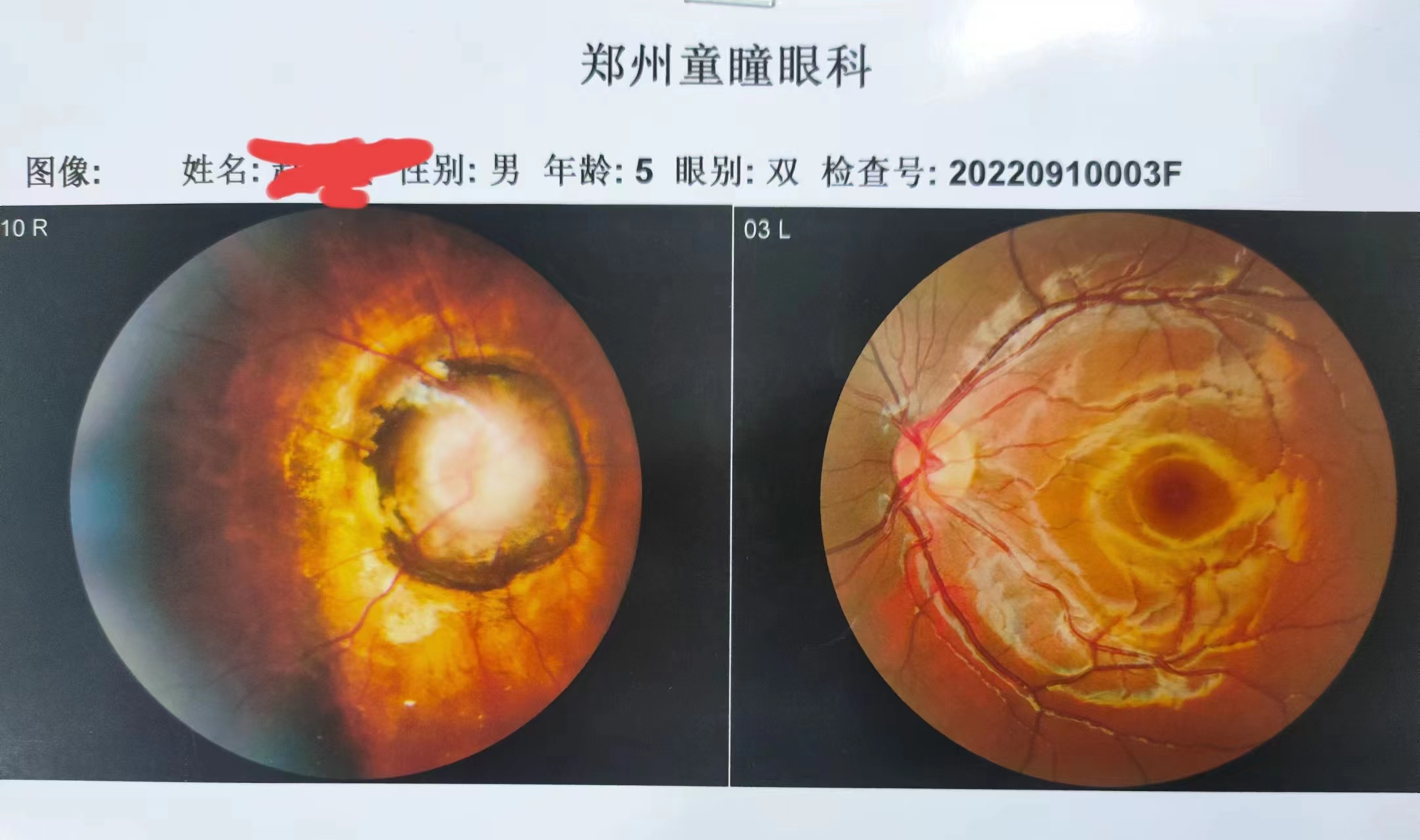 凝聚医患情—牵牛花综合征患者的一面锦旗