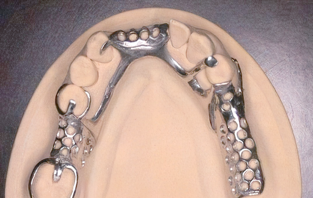 卡环种类大揭秘,一文教你轻松掌握