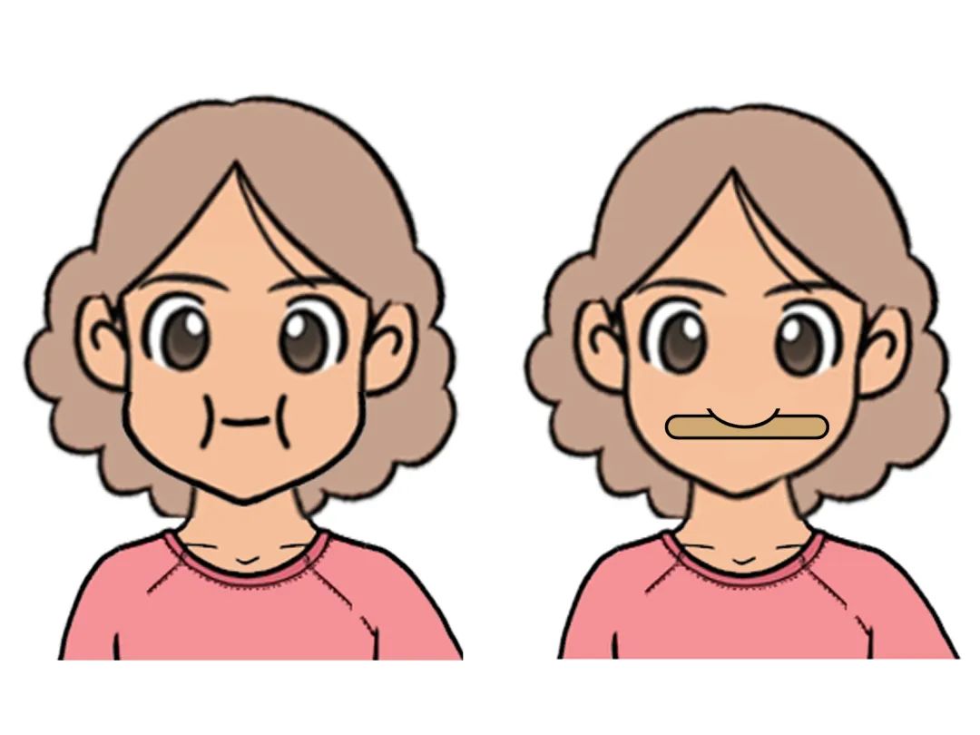 帕金森病吞咽康复科普小知识