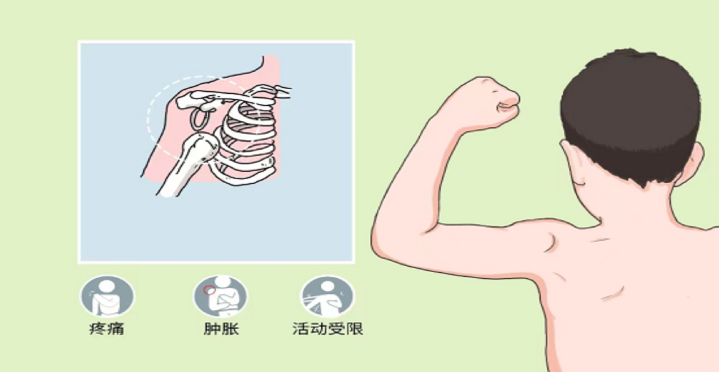 脱臼图片卡通图片