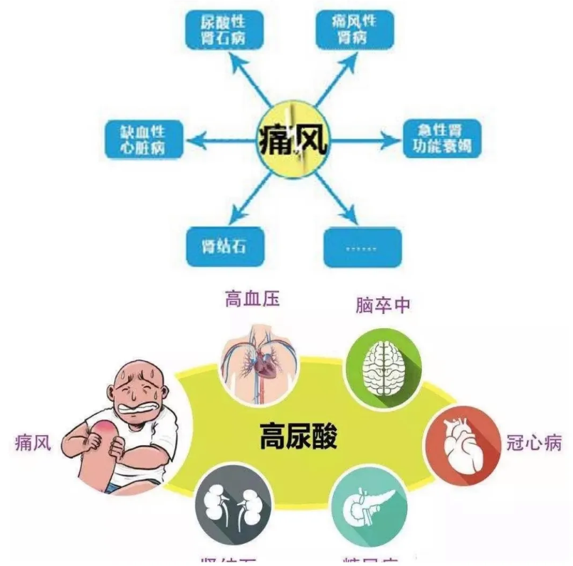 痛风急性发作图片